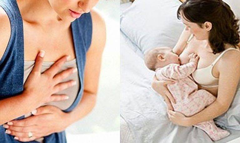 Заболевания молочной железы (мастит, мастопатия, рак молочной железы). диагностика и лечение