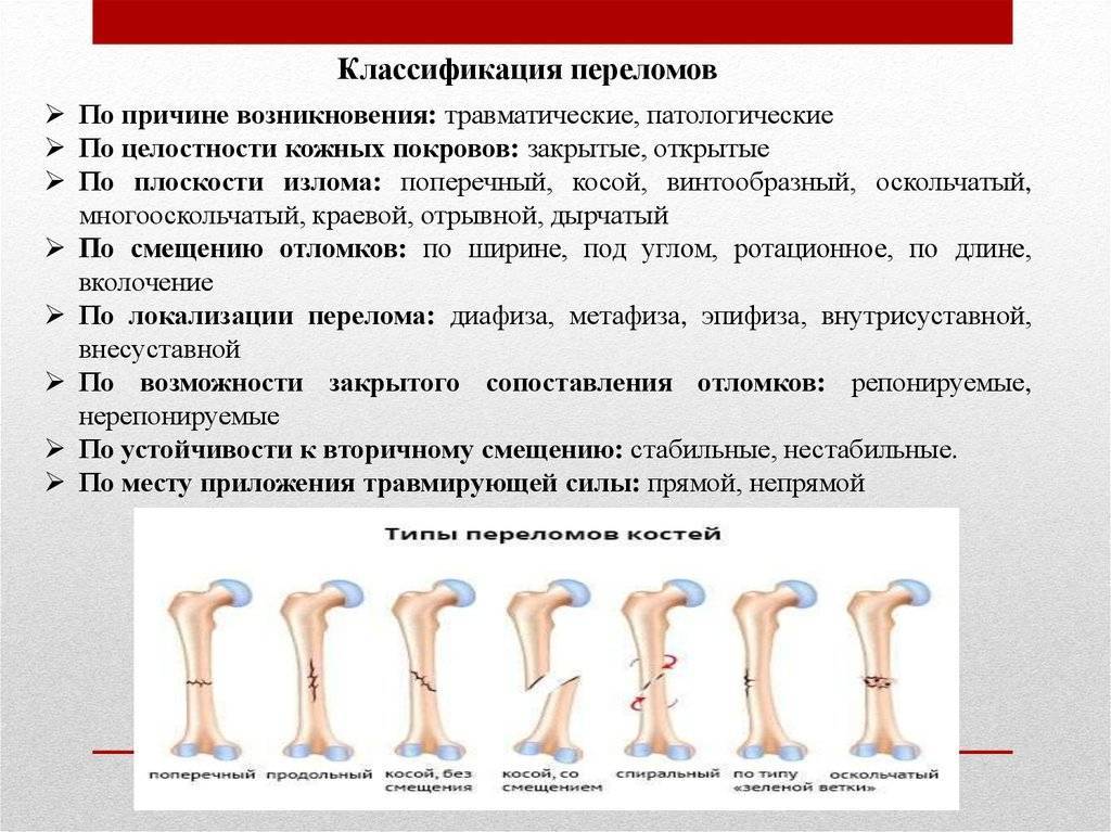 Переломы костей у детей