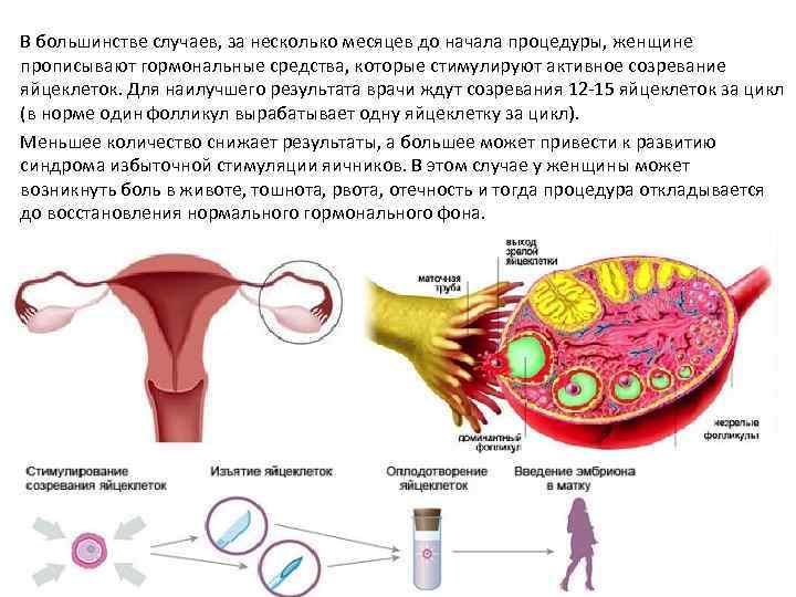 Эко (метод экстракорпорального оплодотворения) - эмбрион