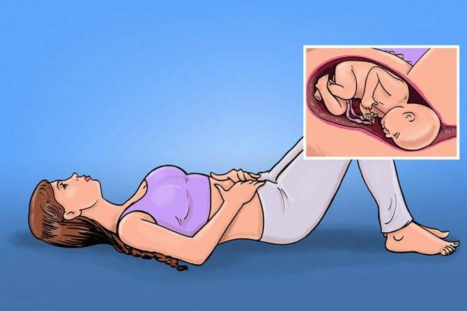 Комплекс профилактических упражнений для беременных при симфизите: «кошечка» и другие элементы