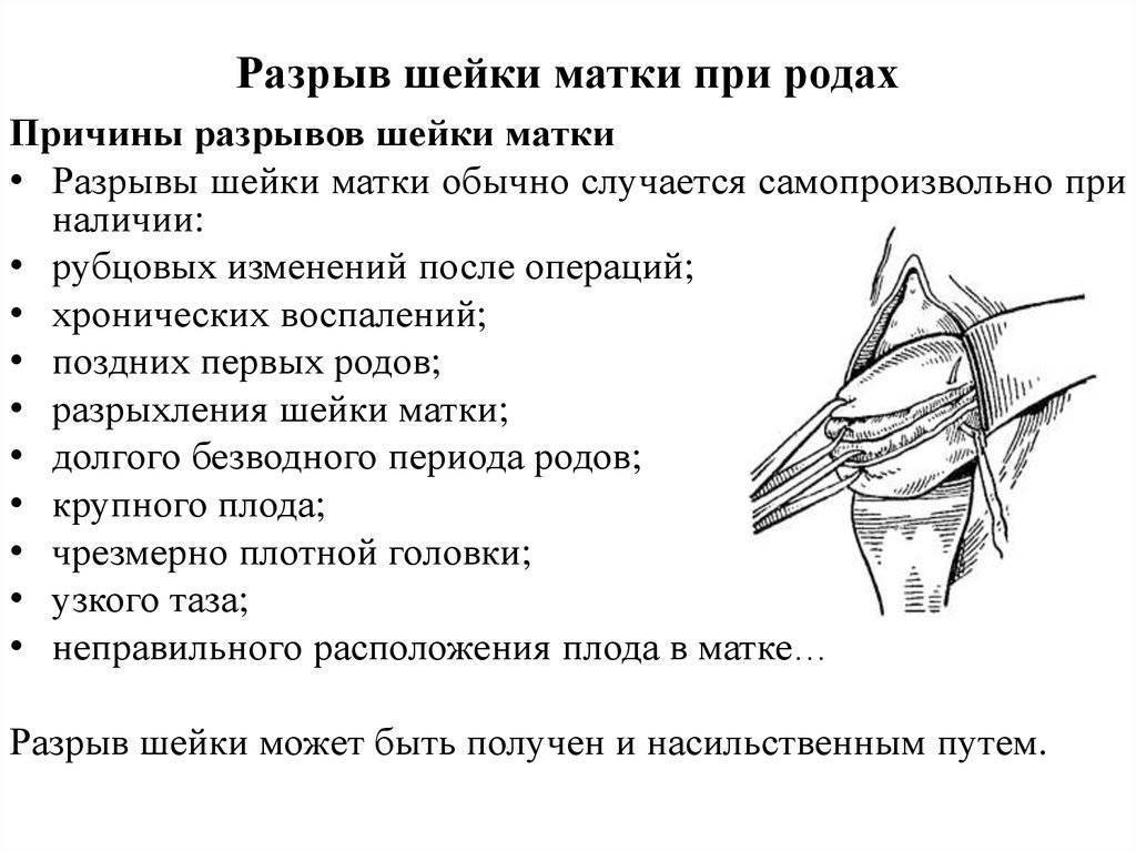 Устранение рубцовой деформации промежности - центр эстетической медицины