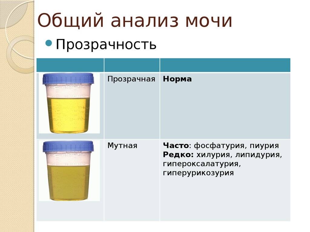 Почему у 4 месячного ребенка желтая моча