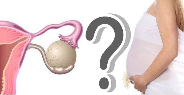 Возможна ли беременность с одним яичником?