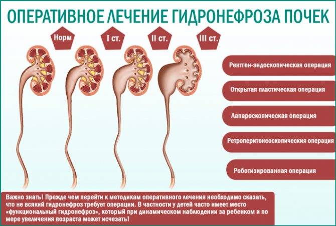 Обследование почек. анализы. кровь, слизь, песок, камни в моче.