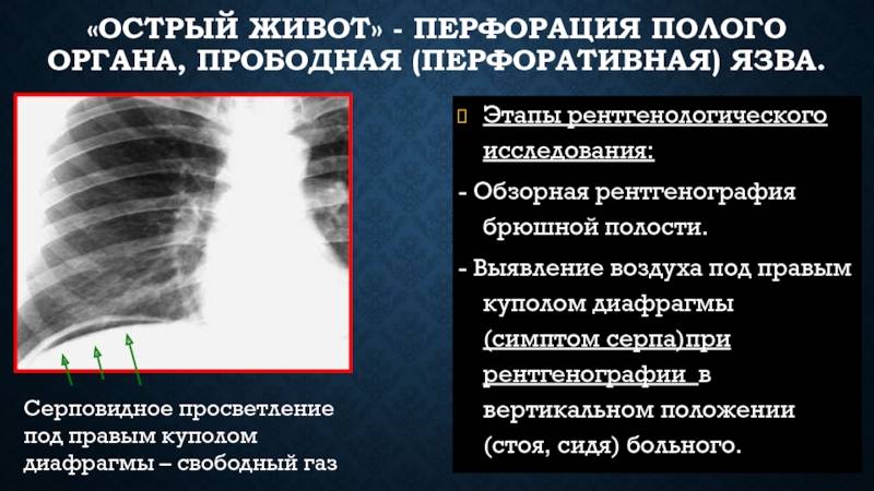 Статьи